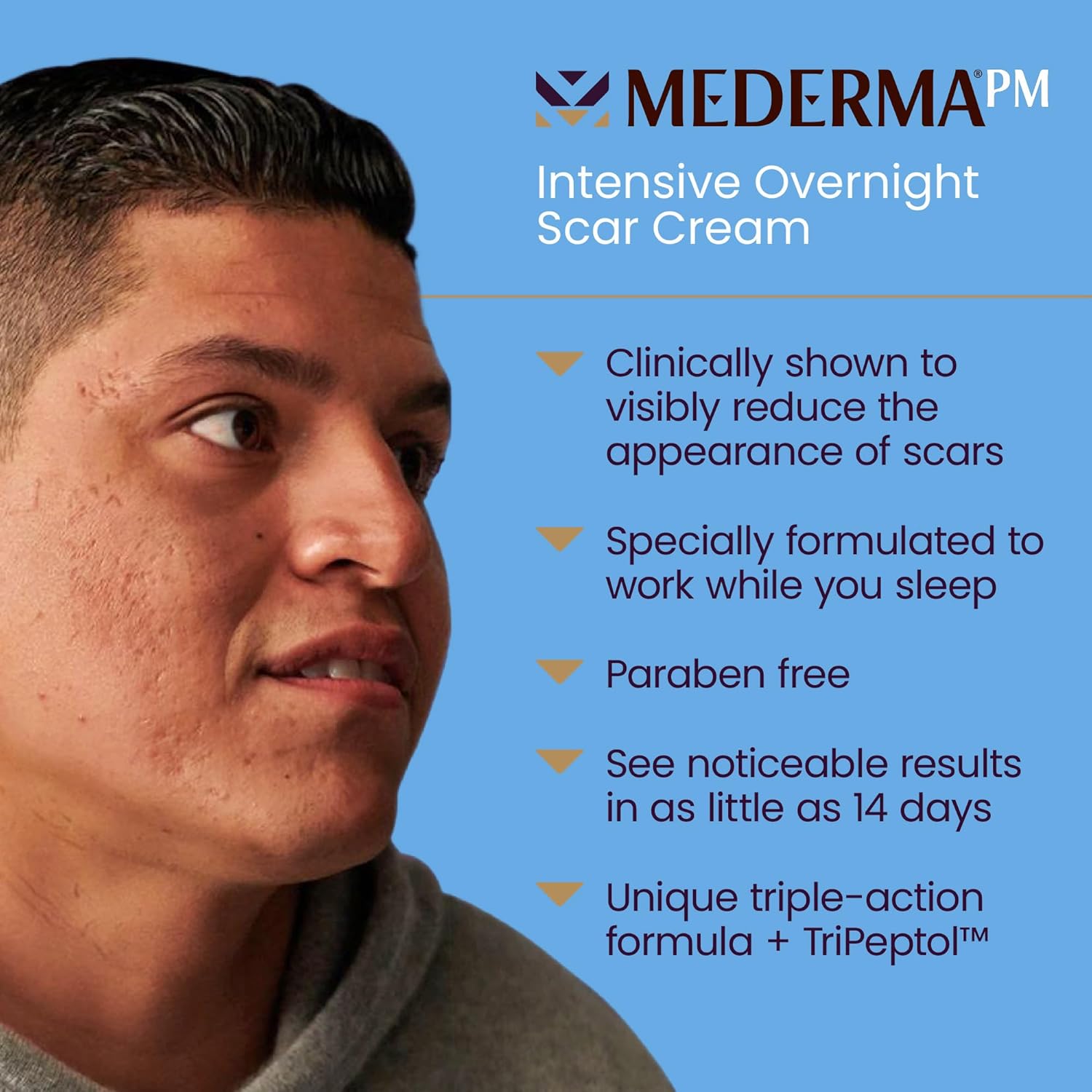 Intensive Overnight Scar Cream, 1.0 Oz J55875